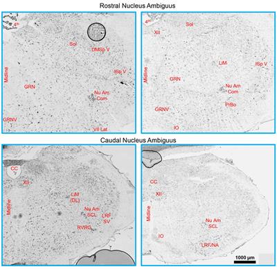 Dendritic morphology of motor neurons and interneurons within the compact, semicompact, and loose formations of the rat nucleus ambiguus